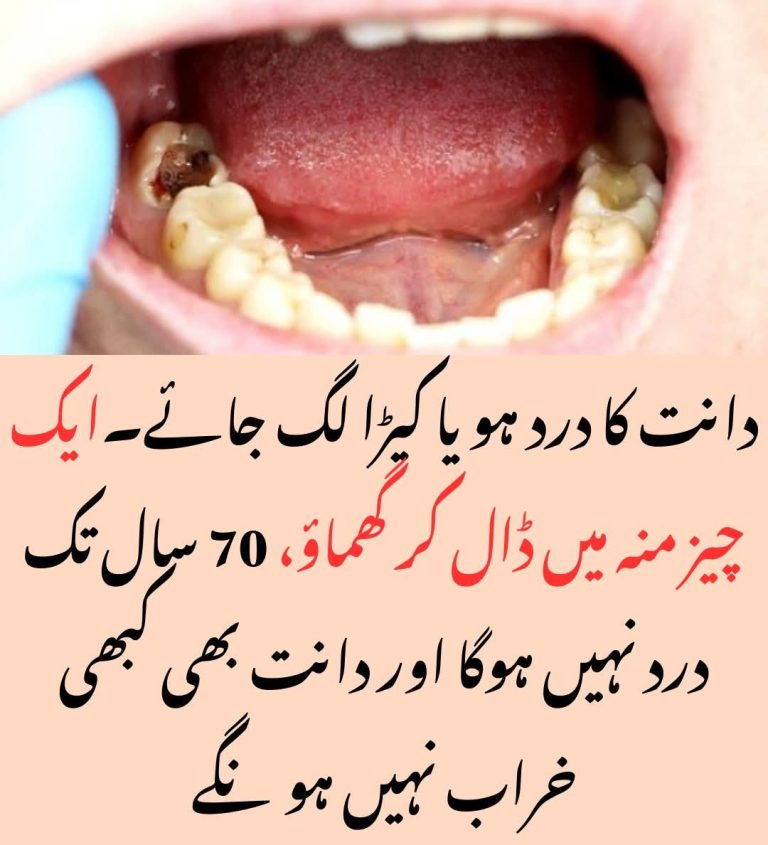 دانت کا کپڑا ایک منٹ میں نکال پھینکنے والا گھر یلو نسخہ دانت درد بھی فوراً غائب